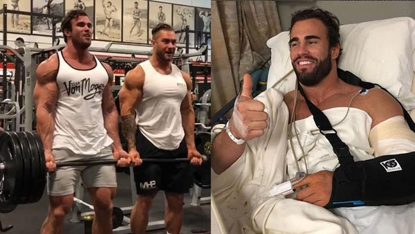 All About Calum Von Moger Injury